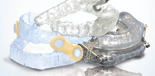oral appliance - mouth guard